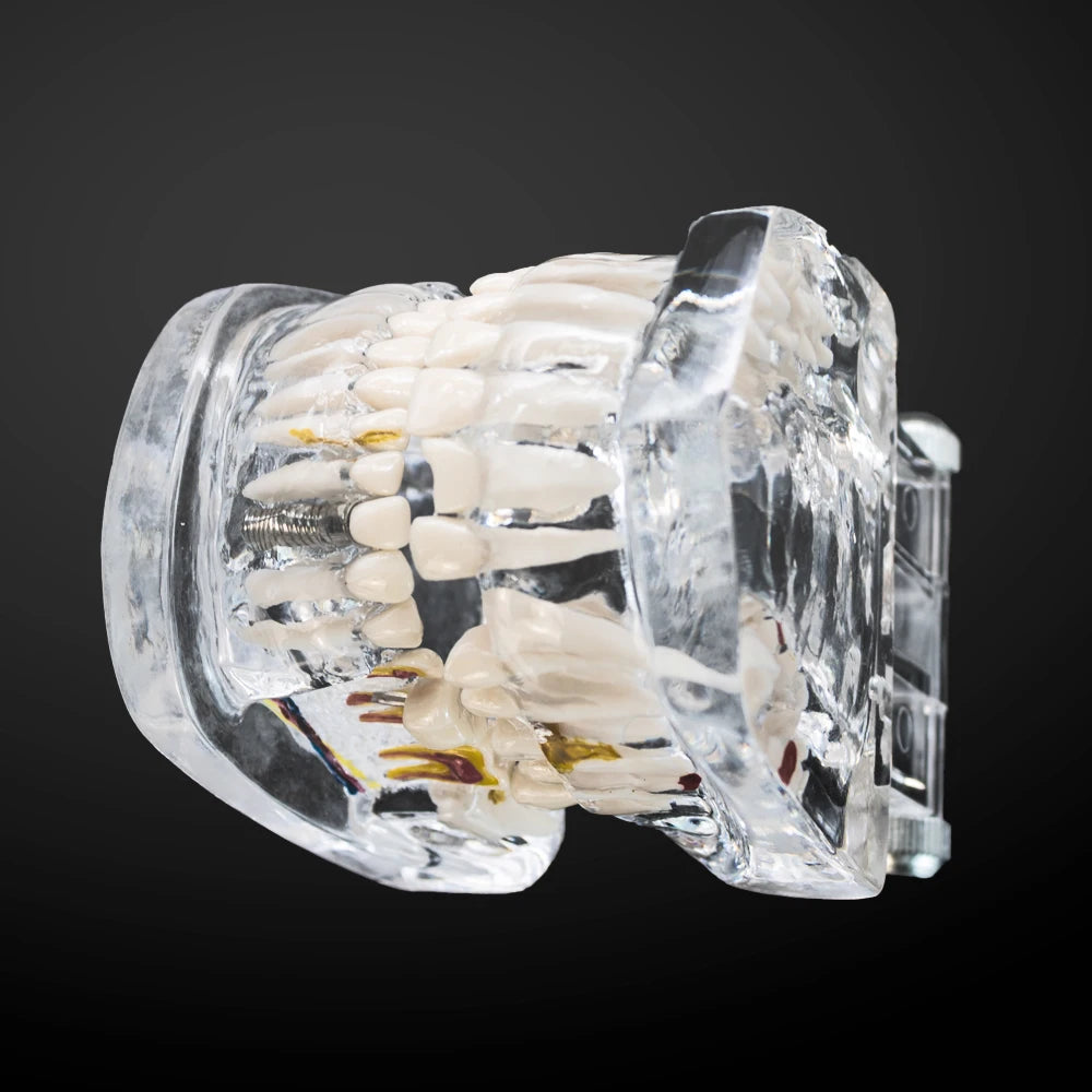 Transparent Oral Pathology Teaching Model