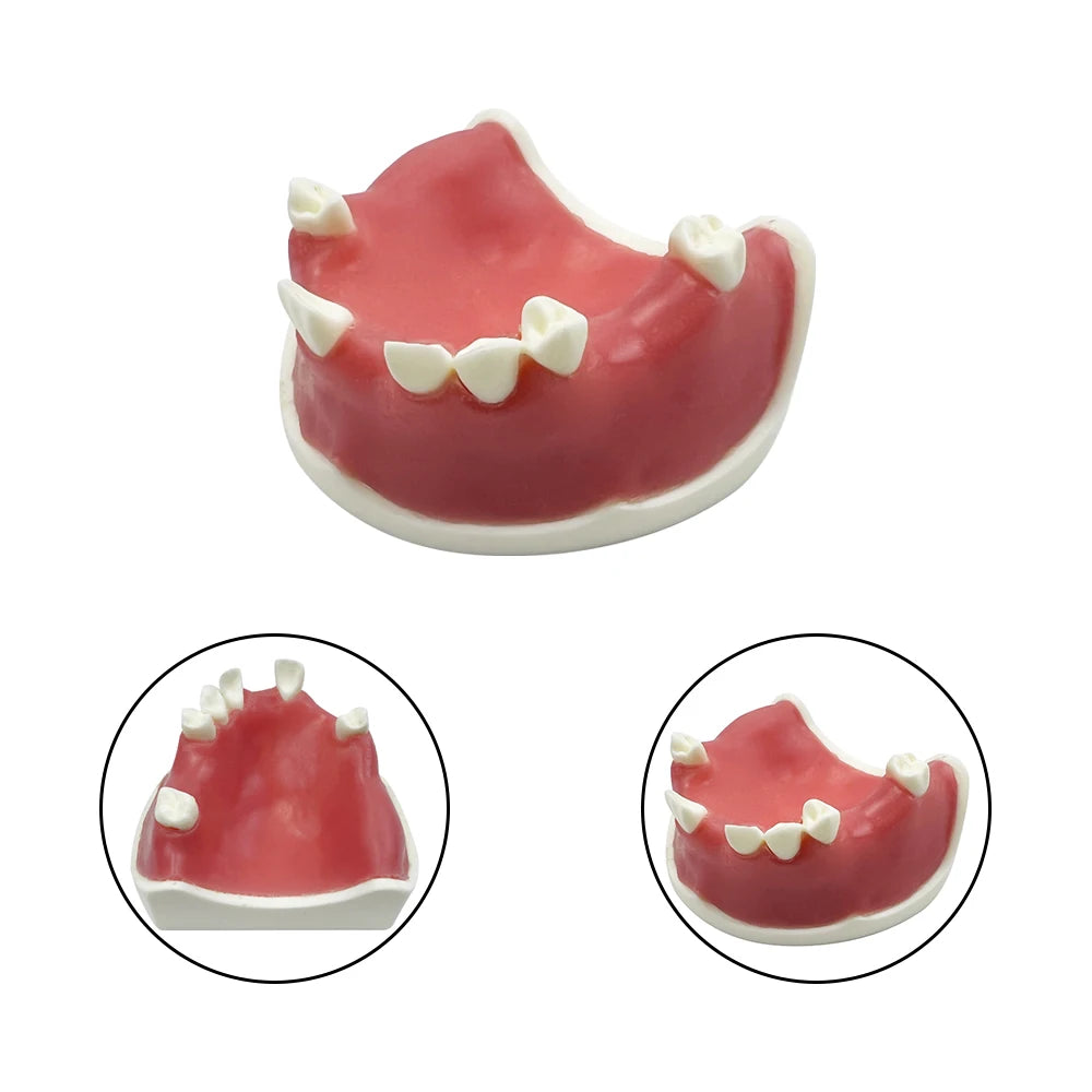 Maxillary Sinus & Implant Teaching Model (Soft Gum)