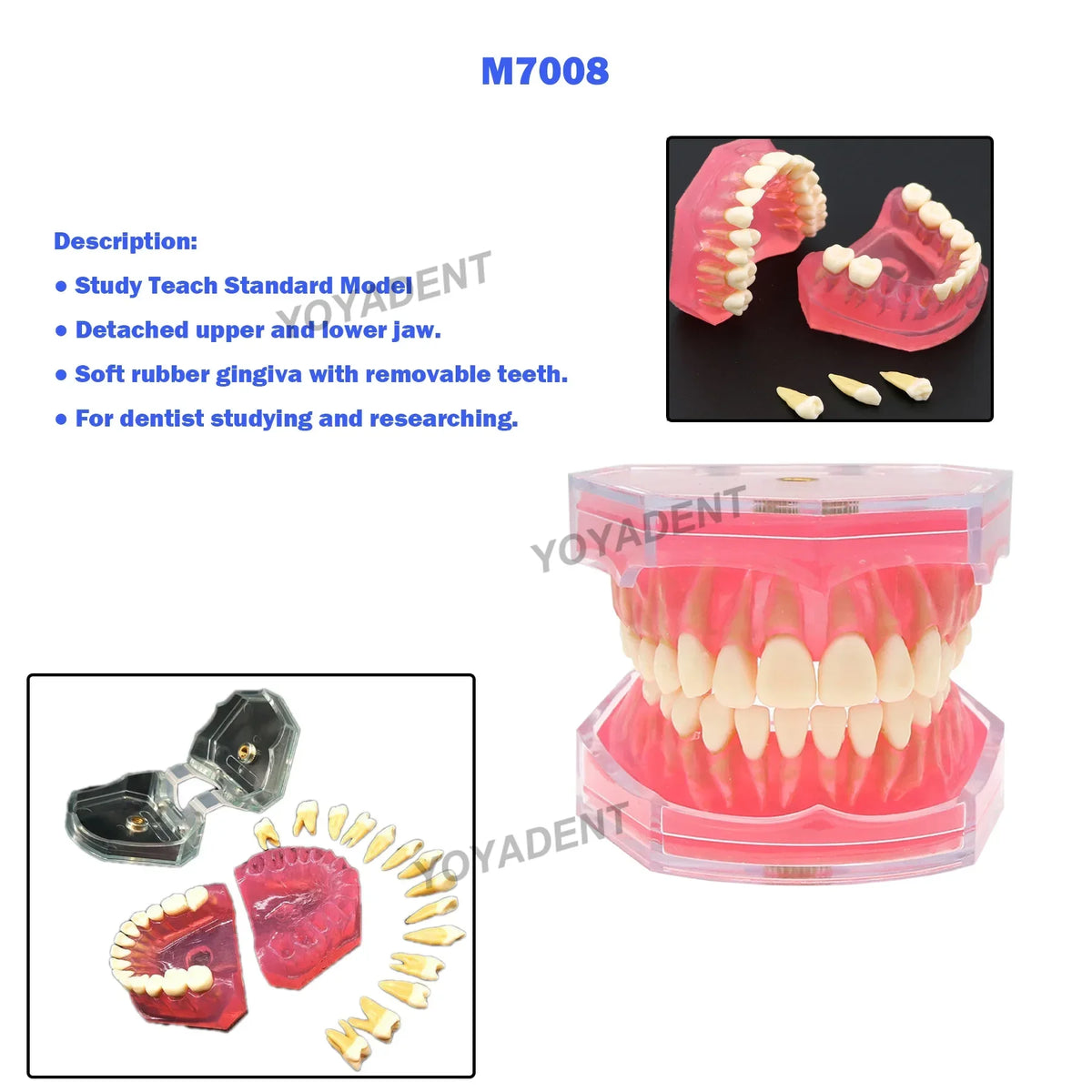 Detached Jaw Implant Training Model