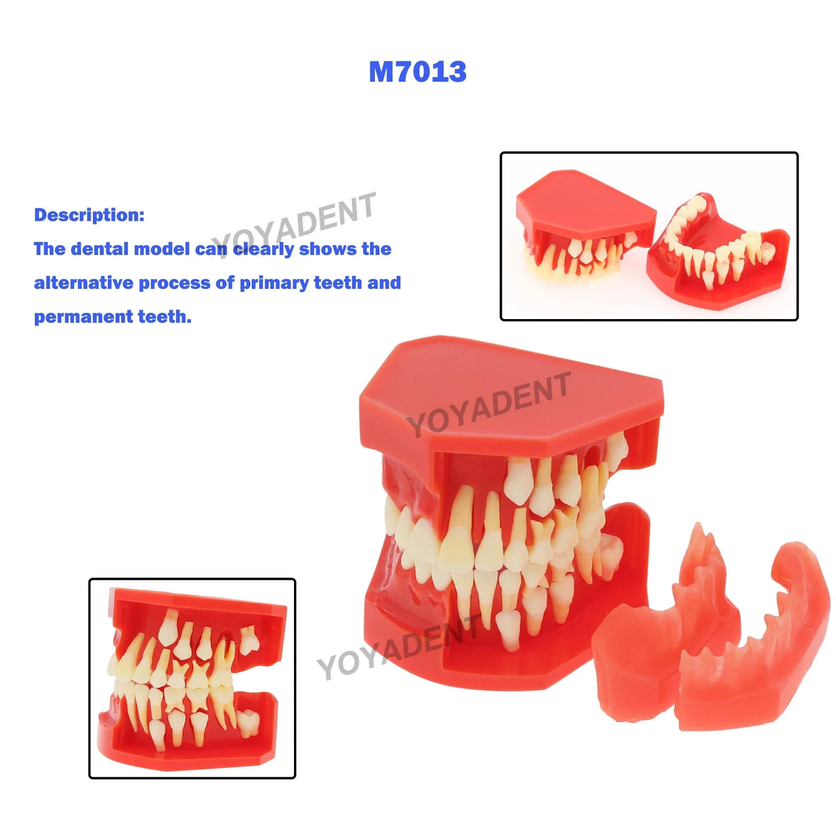 Mixed-Dentition Deciduous-to-Permanent Tooth Replacement Model