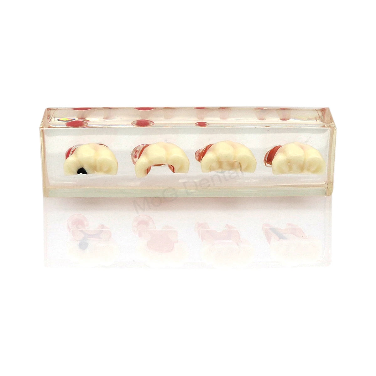 Root Canal Anatomy Teaching Model
