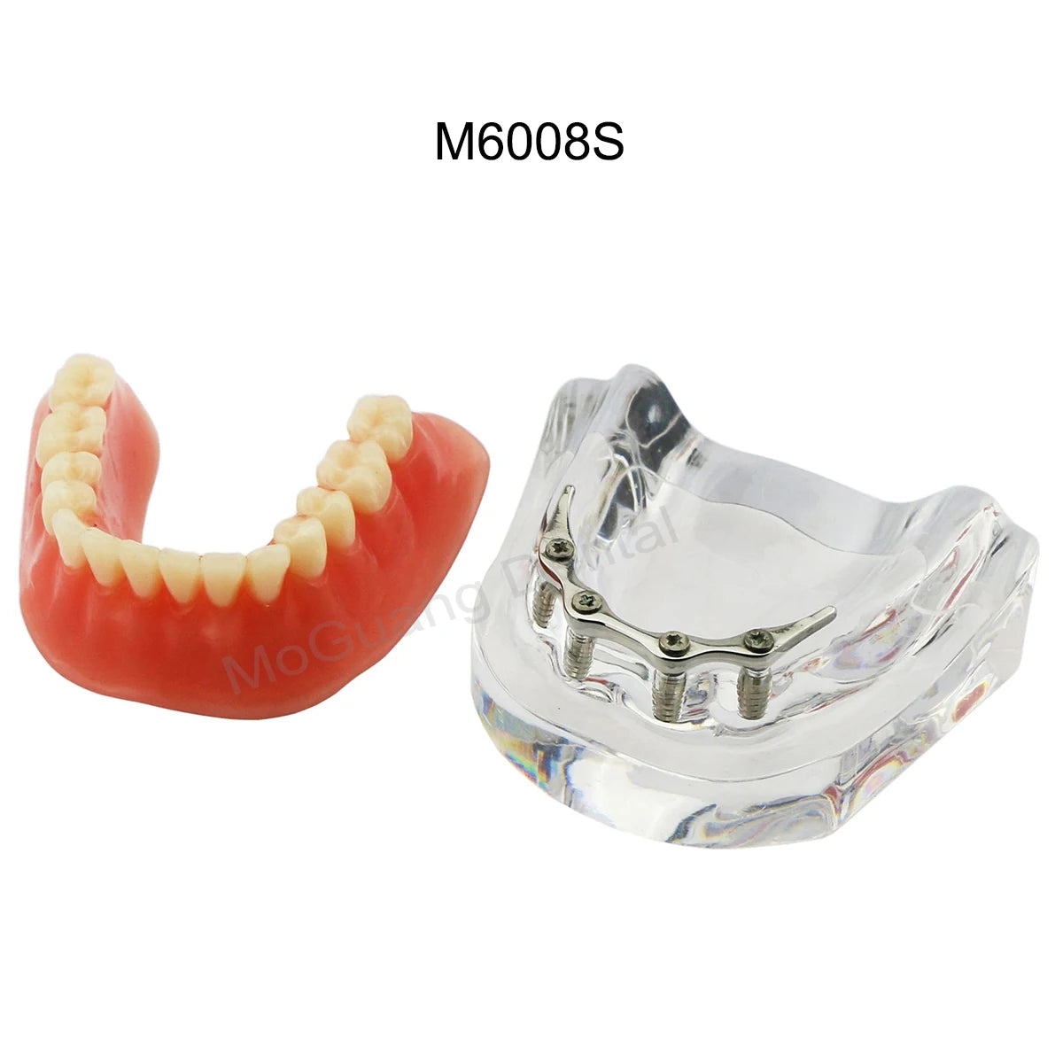 Dental Teeth Model Implant with Removable Dental Education Model for Dentistry Laboratory Demo Studying Dentistry Products Tool