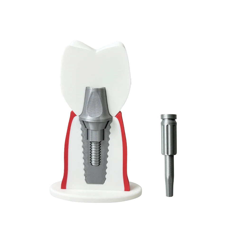 Detachable Implant Demonstration Model (Large)