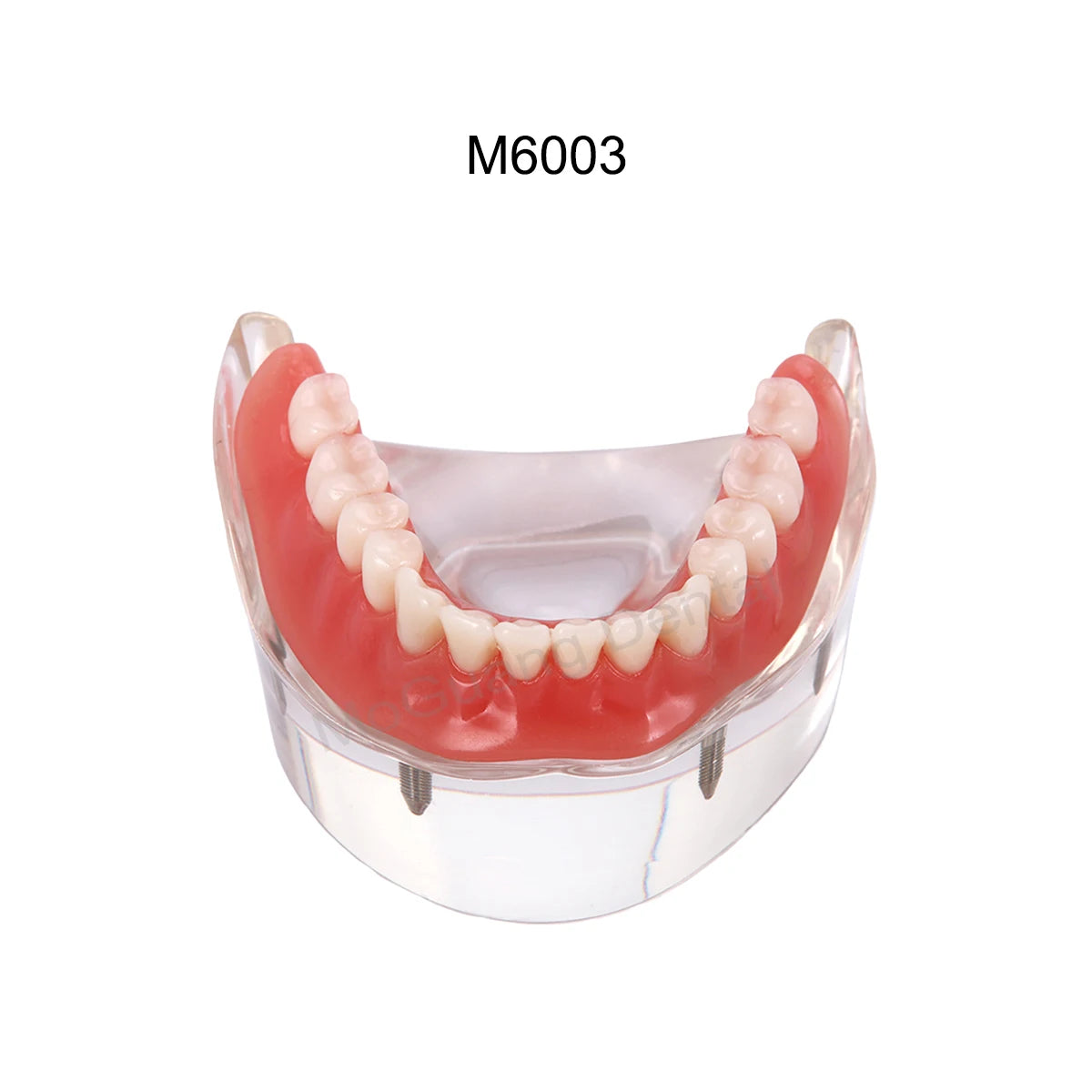 Dental Teeth Model Implant with Removable Dental Education Model for Dentistry Laboratory Demo Studying Dentistry Products Tool