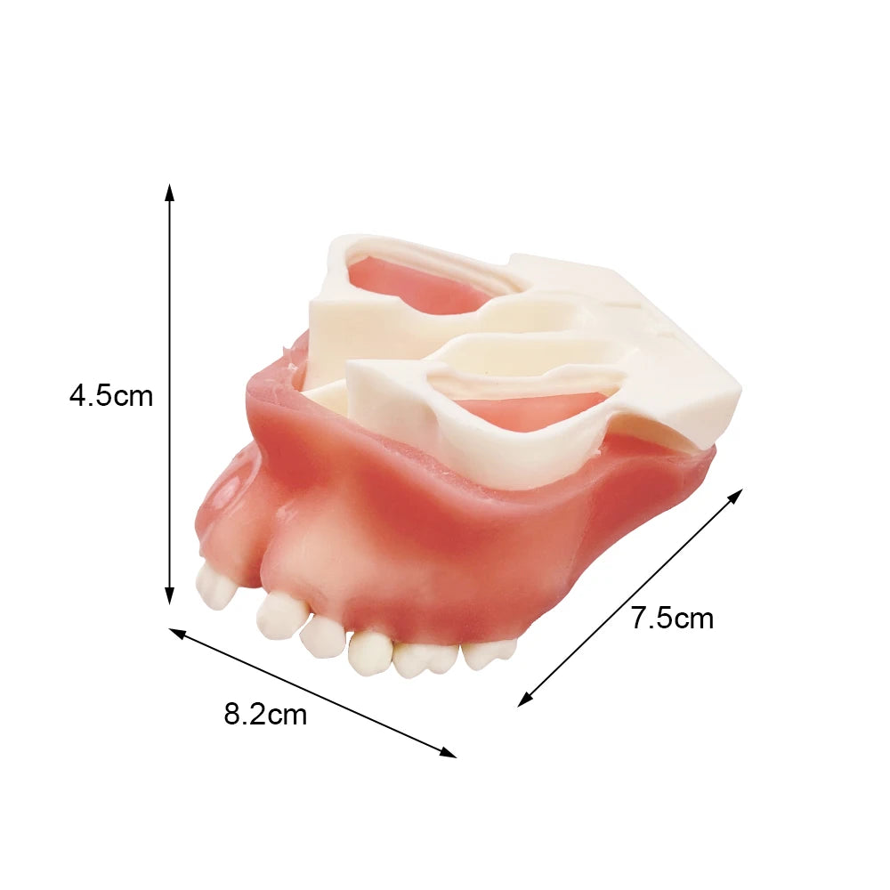 Maxillary Sinus & Implant Teaching Model (Soft Gum)