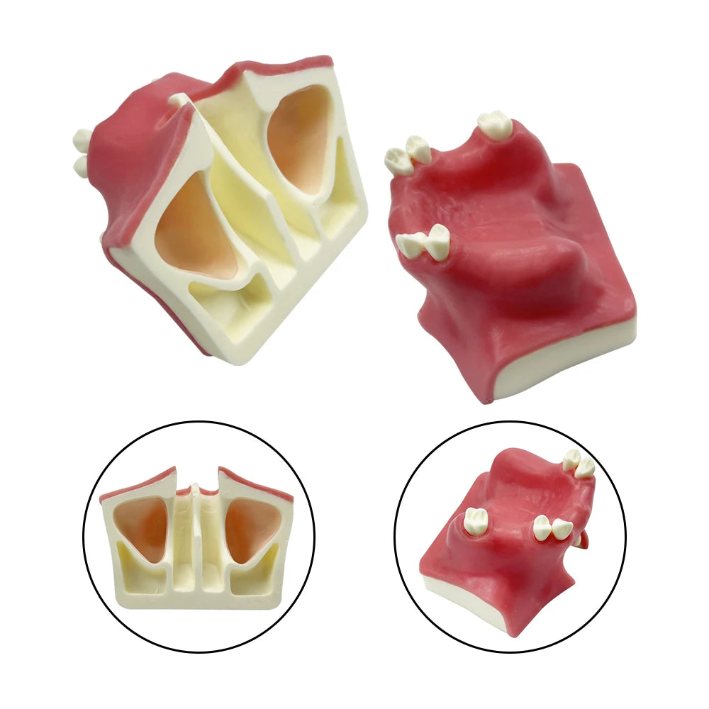 Maxillary Sinus & Implant Teaching Model (Soft Gum)
