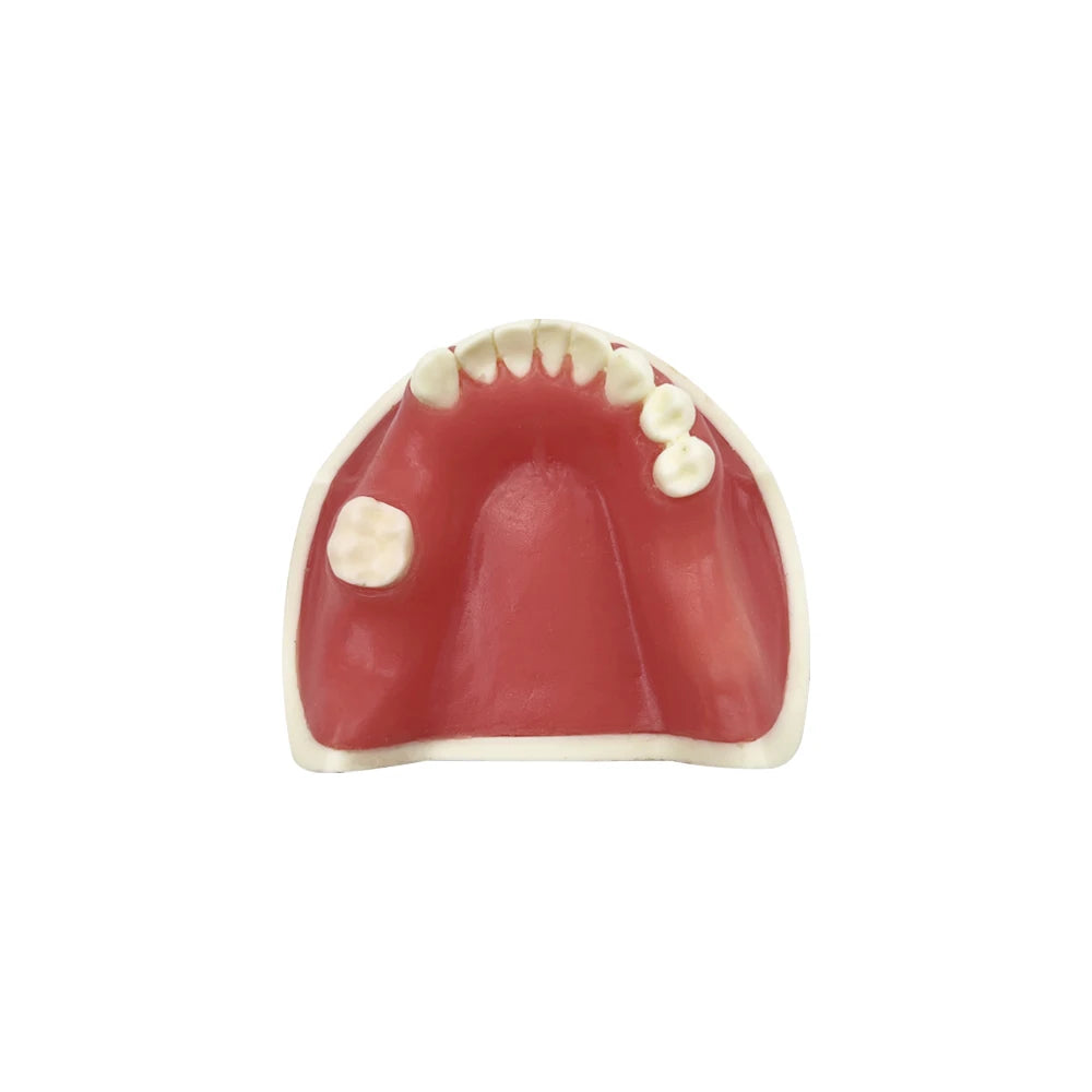 Maxillary Sinus & Implant Teaching Model (Soft Gum)
