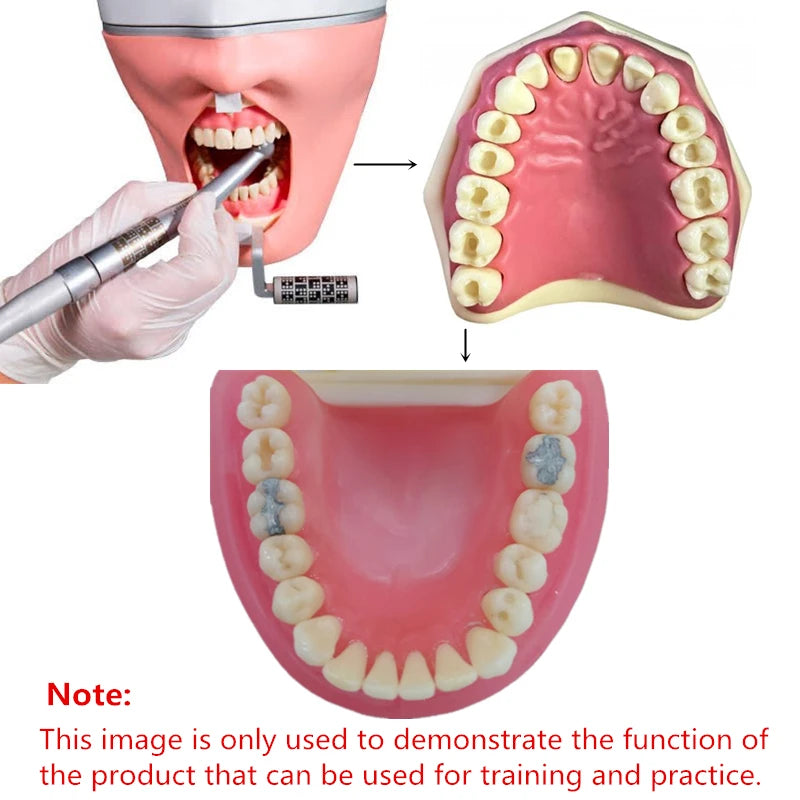 Typodont Practice Model with Removable Teeth