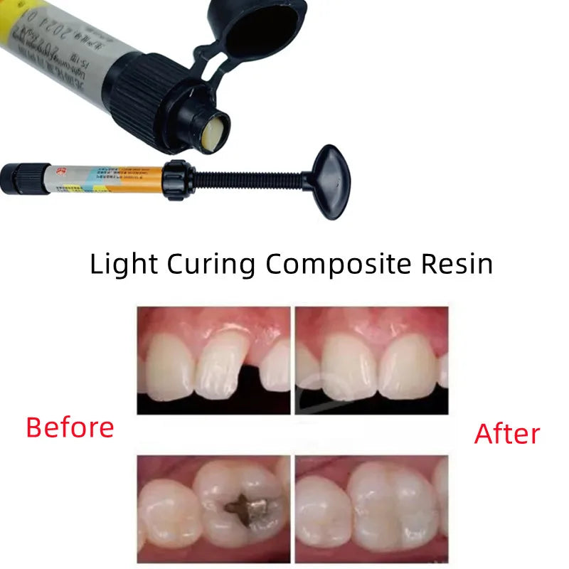 Light-Cure Universal Bonding & Filling Resin (2.5g)