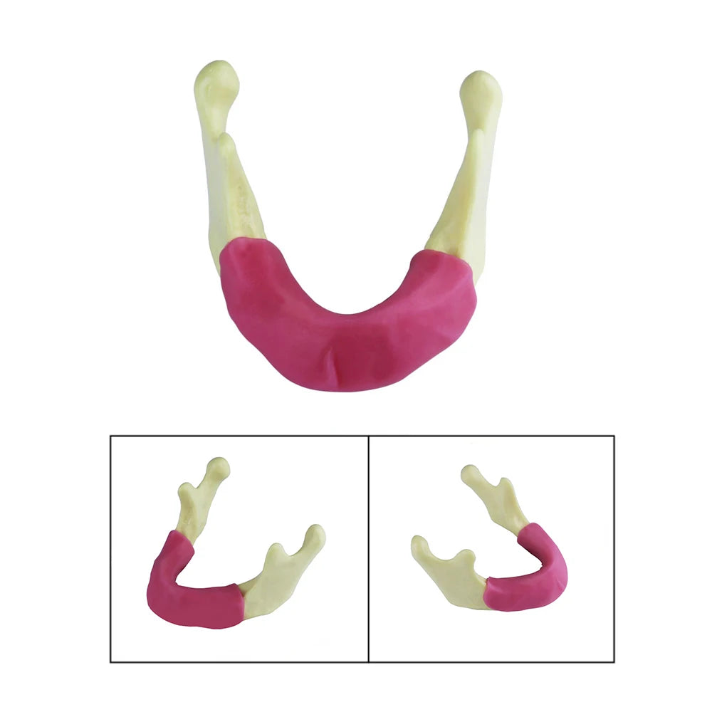 Maxillary Sinus & Implant Teaching Model (Soft Gum)