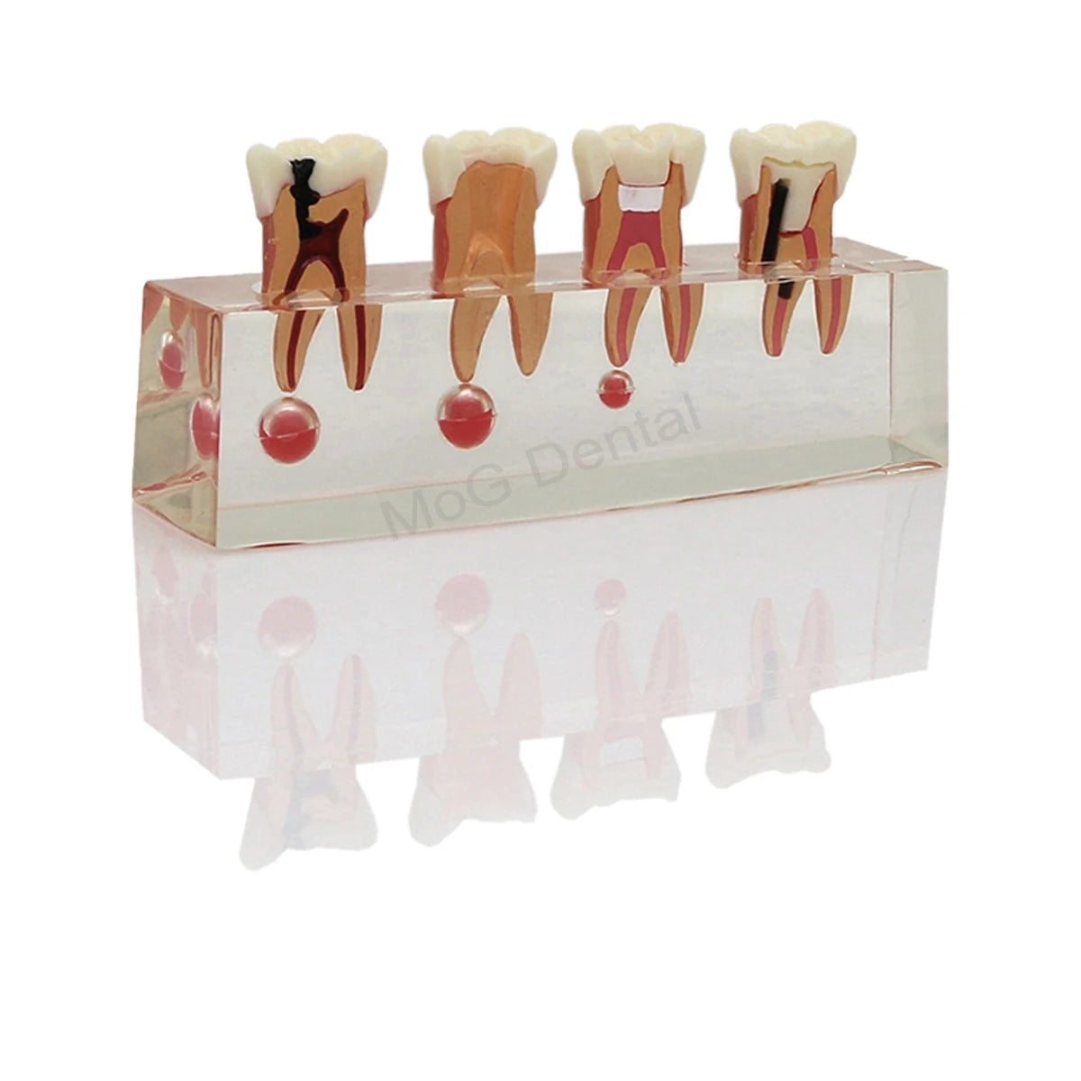 Root Canal Anatomy Teaching Model