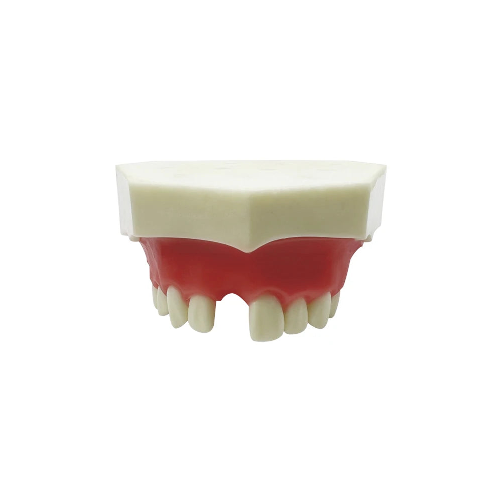 Maxillary Sinus & Implant Teaching Model (Soft Gum)