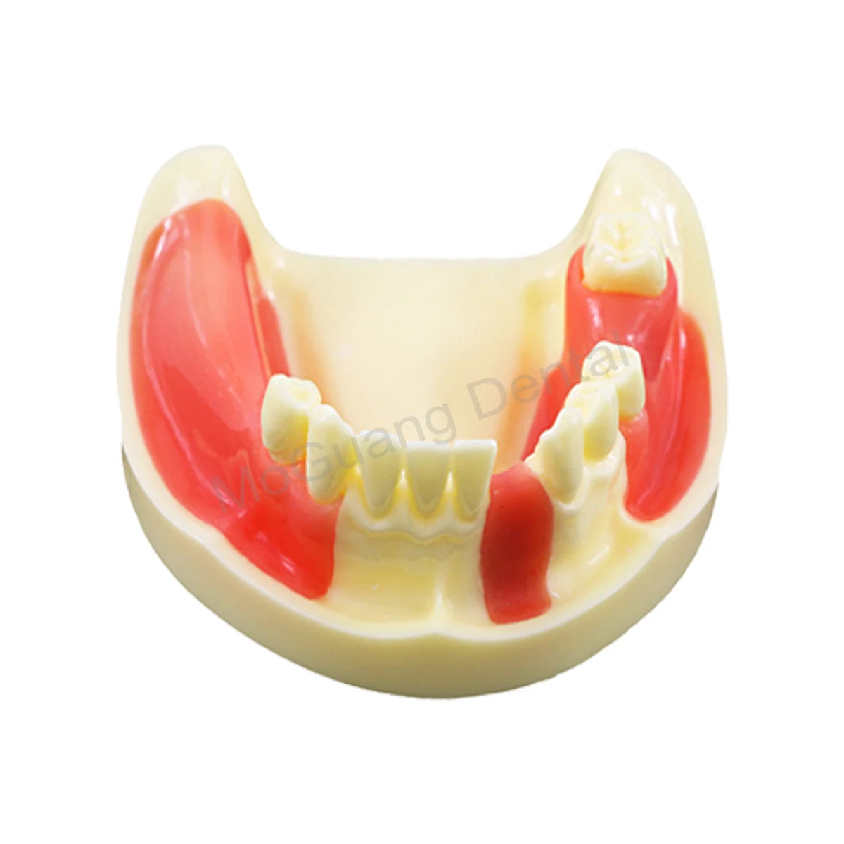 Dental Teeth Model Implant with Removable Dental Education Model for Dentistry Laboratory Demo Studying Dentistry Products Tool