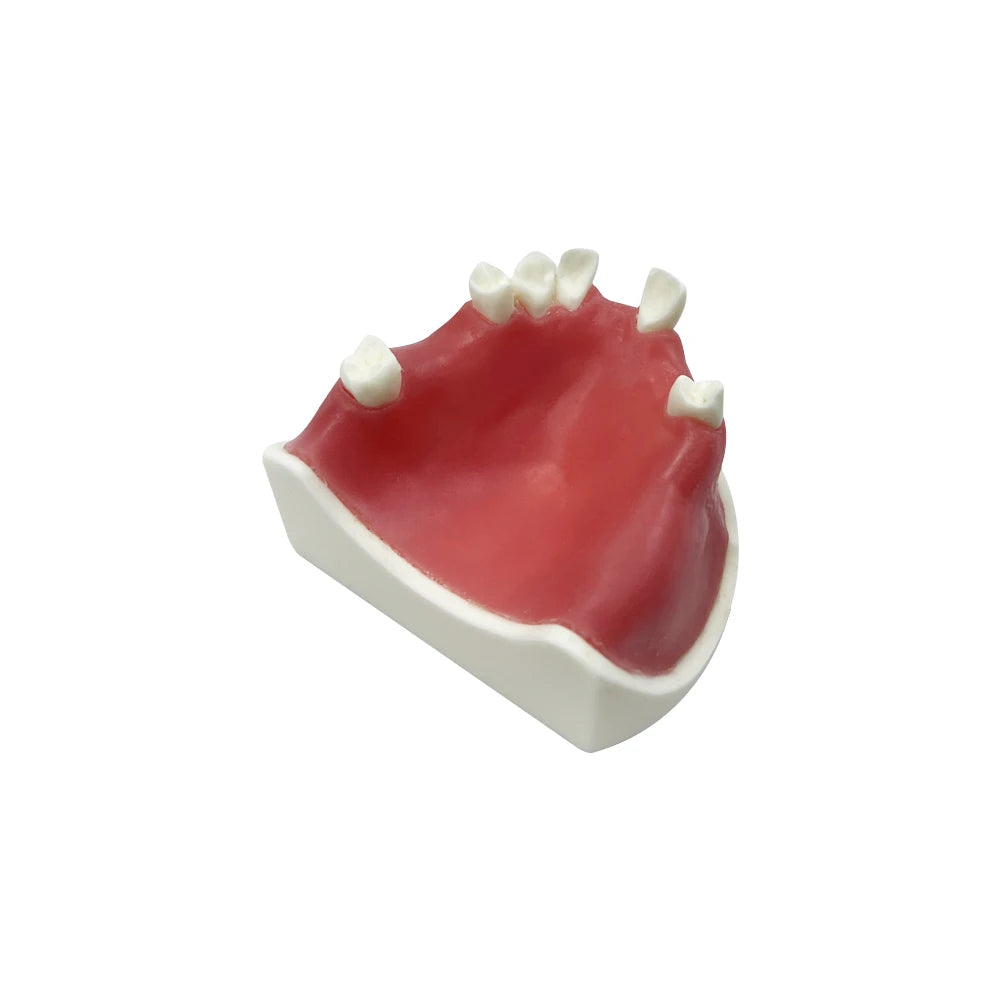 Maxillary Sinus & Implant Teaching Model (Soft Gum)