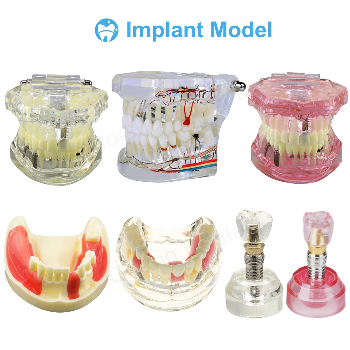 Dental Teeth Model Implant with Removable Dental Education Model for Dentistry Laboratory Demo Studying Dentistry Products Tool