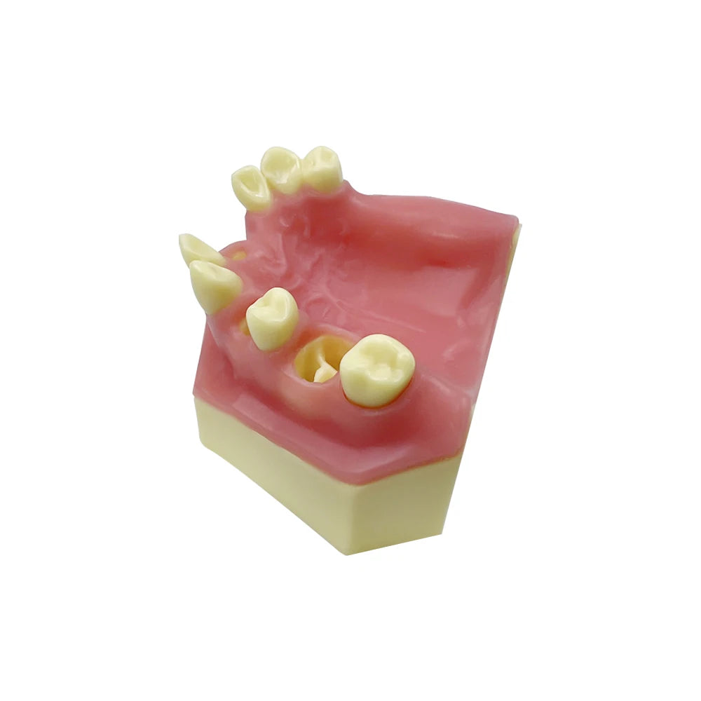 Maxillary Sinus & Implant Teaching Model (Soft Gum)