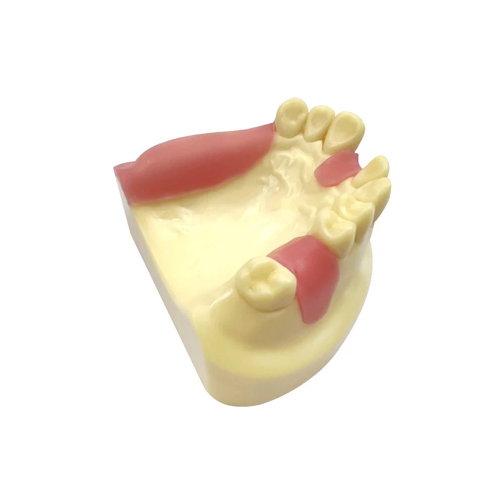 Maxillary Sinus & Implant Teaching Model (Soft Gum)