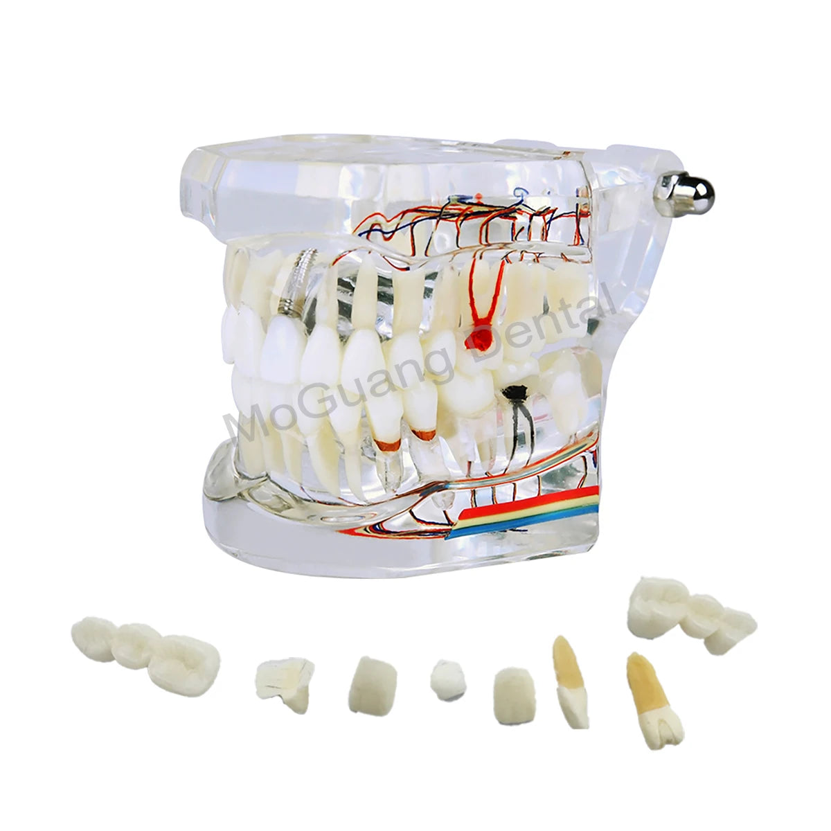 Dental Teeth Model Implant with Removable Dental Education Model for Dentistry Laboratory Demo Studying Dentistry Products Tool