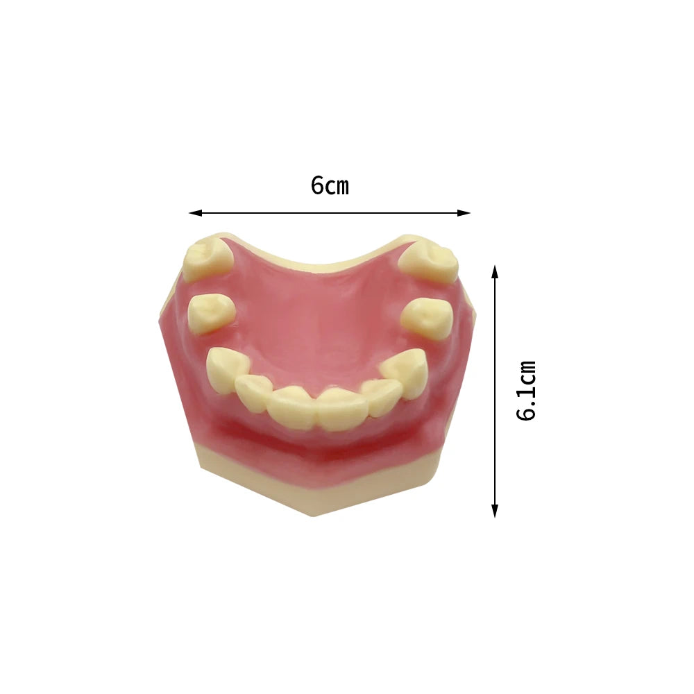 Maxillary Sinus & Implant Teaching Model (Soft Gum)