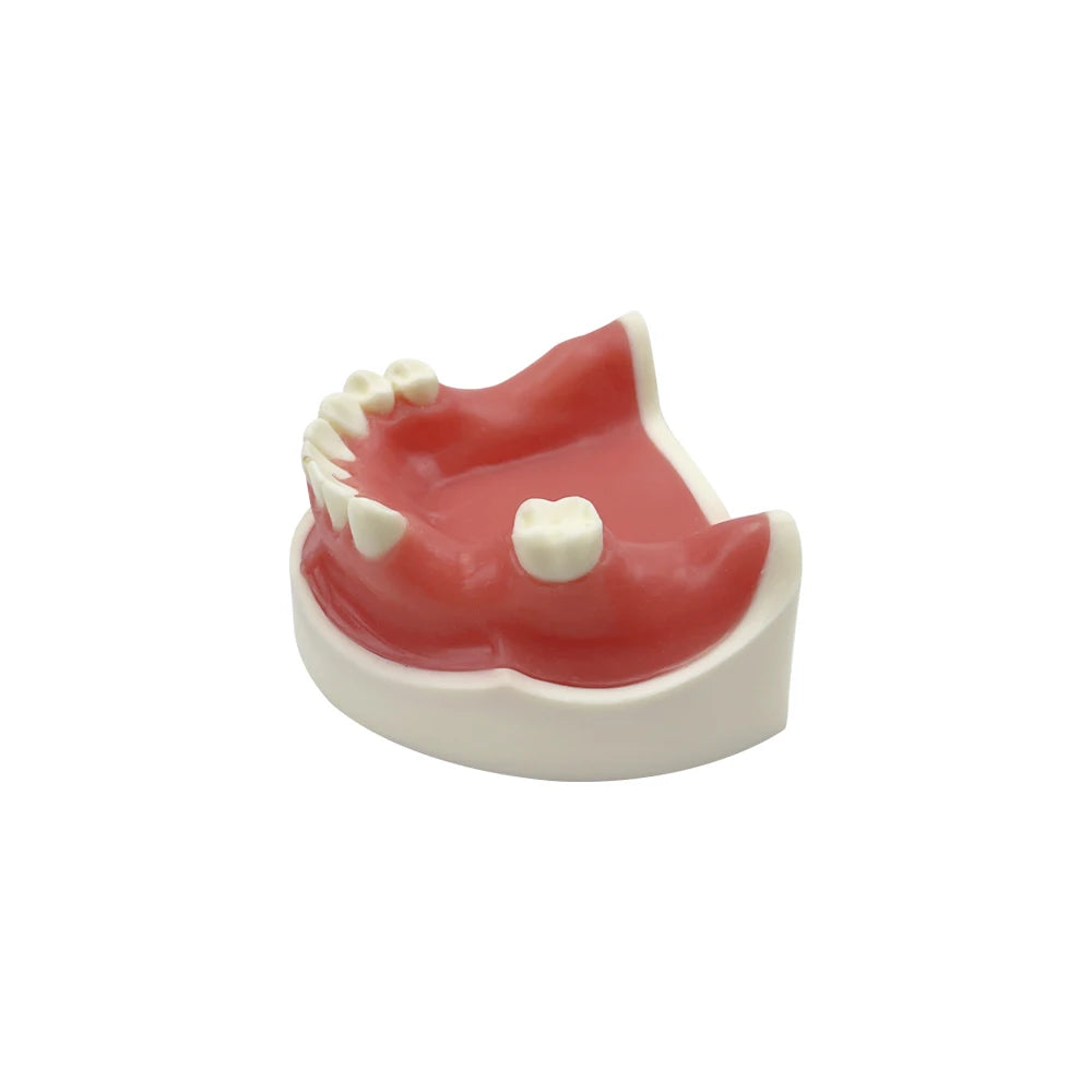 Maxillary Sinus & Implant Teaching Model (Soft Gum)