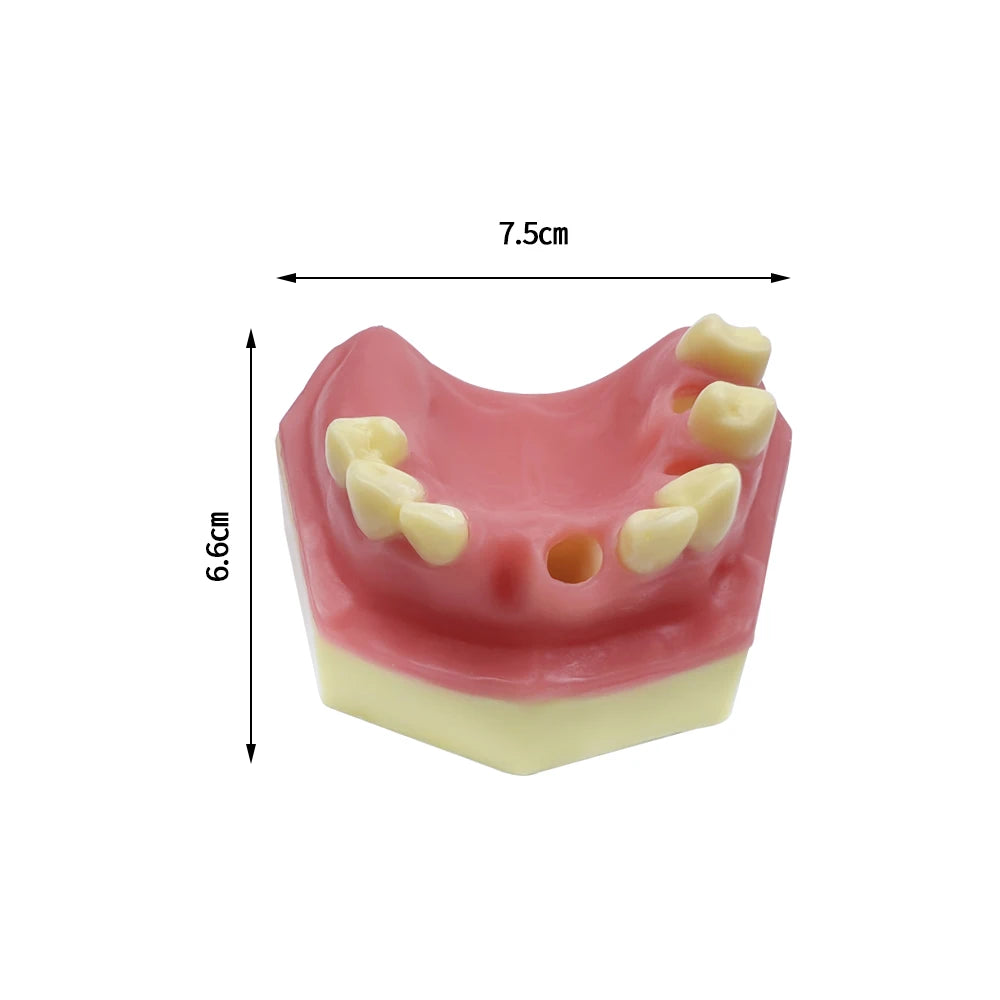 Maxillary Sinus & Implant Teaching Model (Soft Gum)