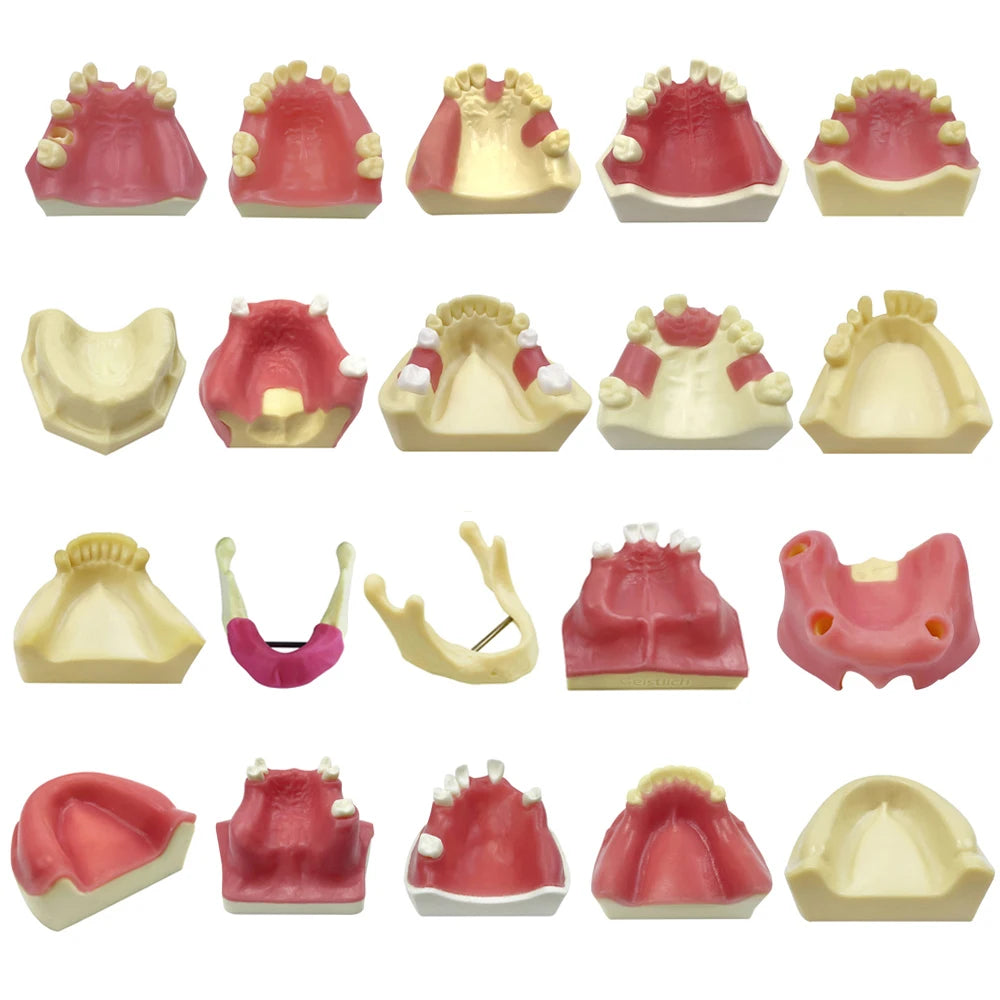 Maxillary Sinus & Implant Teaching Model (Soft Gum)
