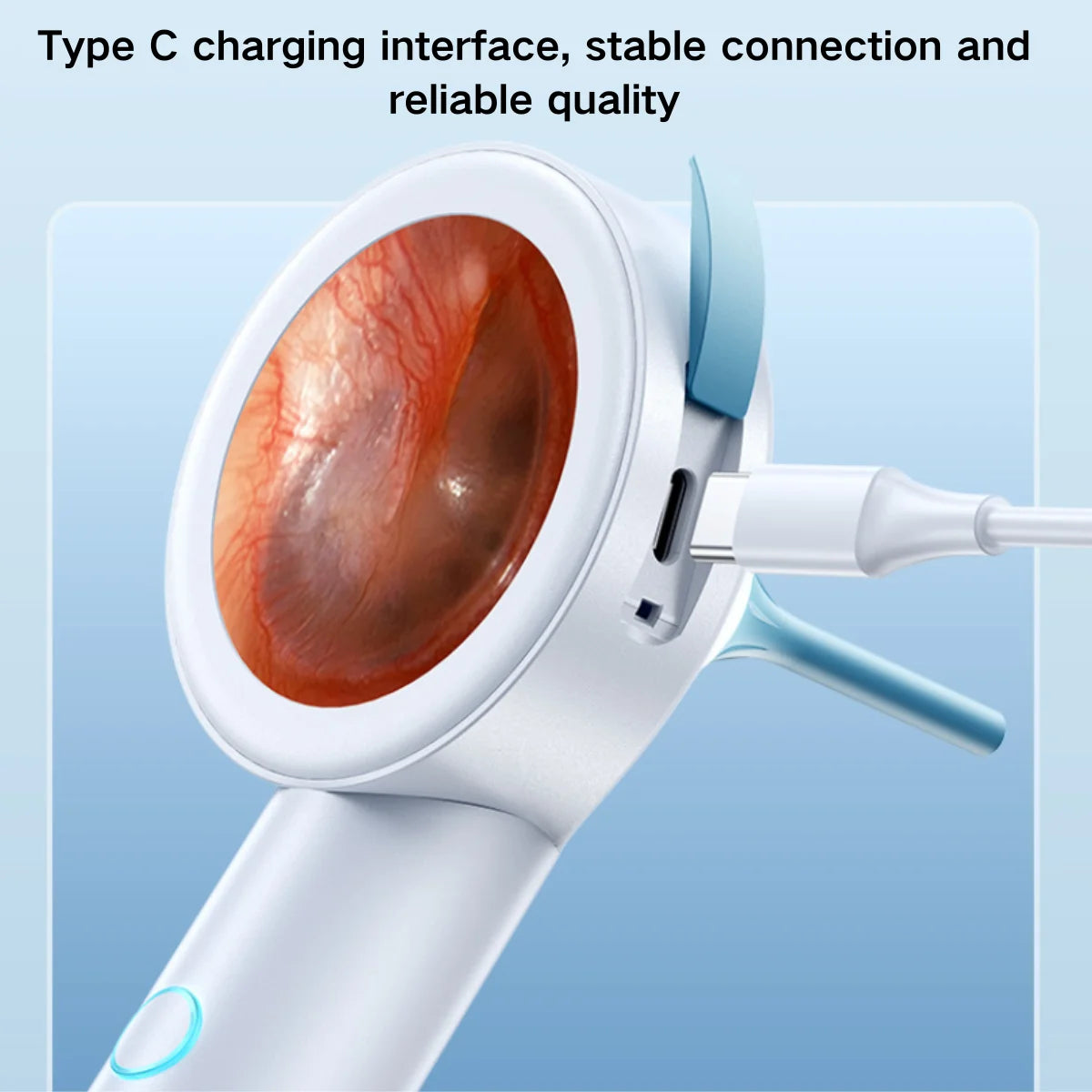 HD Digital Visual Otoscope (Integrated 1.8" Diagnostic Screen)