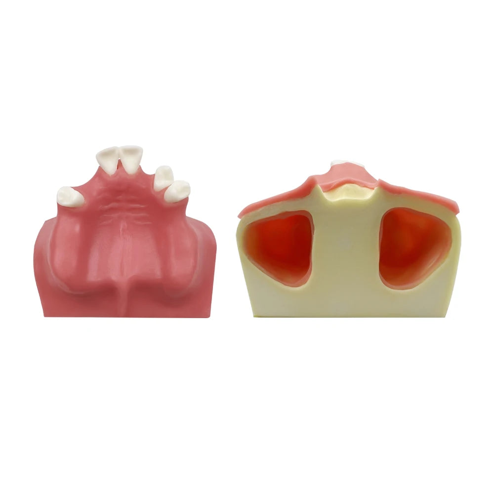 Maxillary Sinus & Implant Teaching Model (Soft Gum)