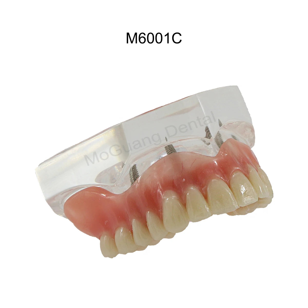 Dental Teeth Model Implant with Removable Dental Education Model for Dentistry Laboratory Demo Studying Dentistry Products Tool