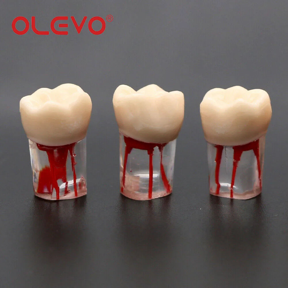 OLEVO 10 Pcs Dental RCT Endo Teeth Model Endodontic Root Canal Block Pulp Cavity Resin Study Practice Endodontic Training M8006