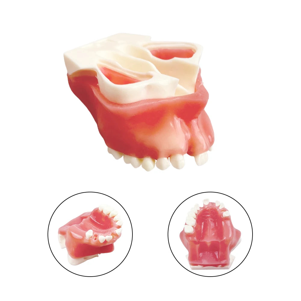 Maxillary Sinus & Implant Teaching Model (Soft Gum)