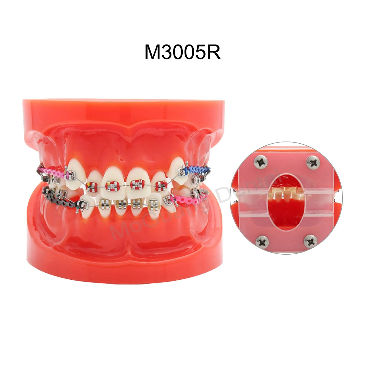 Dental Teeth Model Implant with Removable Dental Education Model for Dentistry Laboratory Demo Studying Dentistry Products Tool