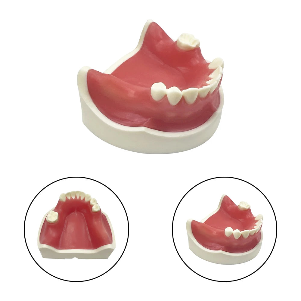 Maxillary Sinus & Implant Teaching Model (Soft Gum)