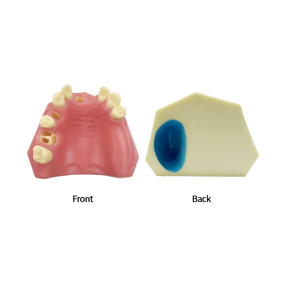Maxillary Sinus & Implant Teaching Model (Soft Gum)