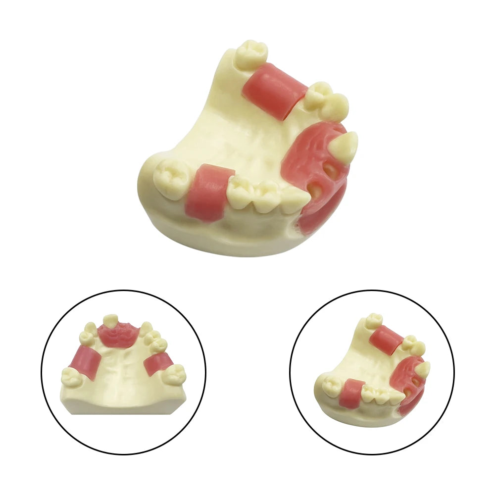 Maxillary Sinus & Implant Teaching Model (Soft Gum)