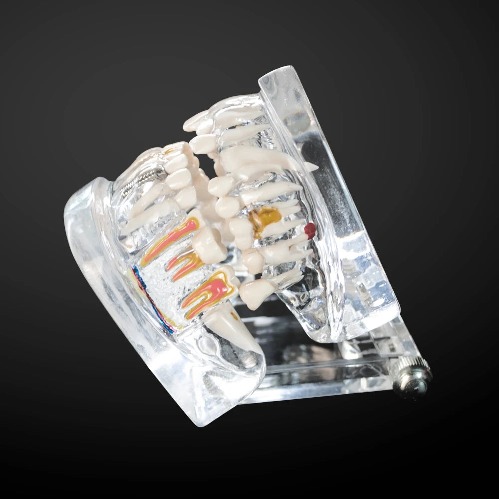 Transparent Oral Pathology Teaching Model