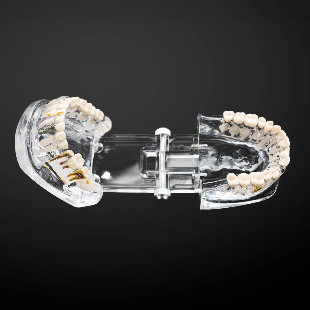 Transparent Oral Pathology Teaching Model