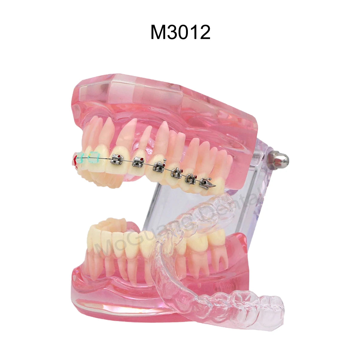 Dental Teeth Model Implant with Removable Dental Education Model for Dentistry Laboratory Demo Studying Dentistry Products Tool