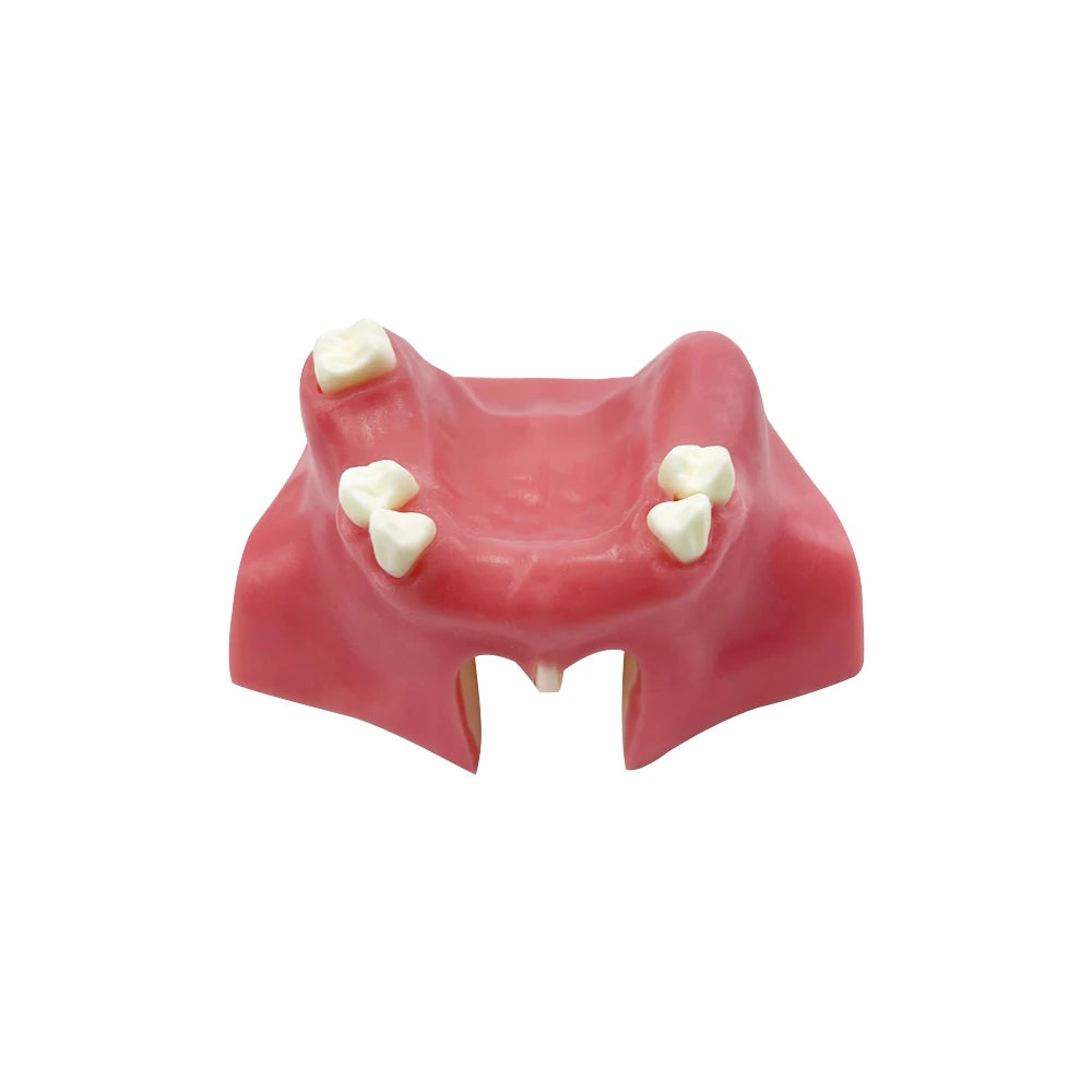 Maxillary Sinus & Implant Teaching Model (Soft Gum)