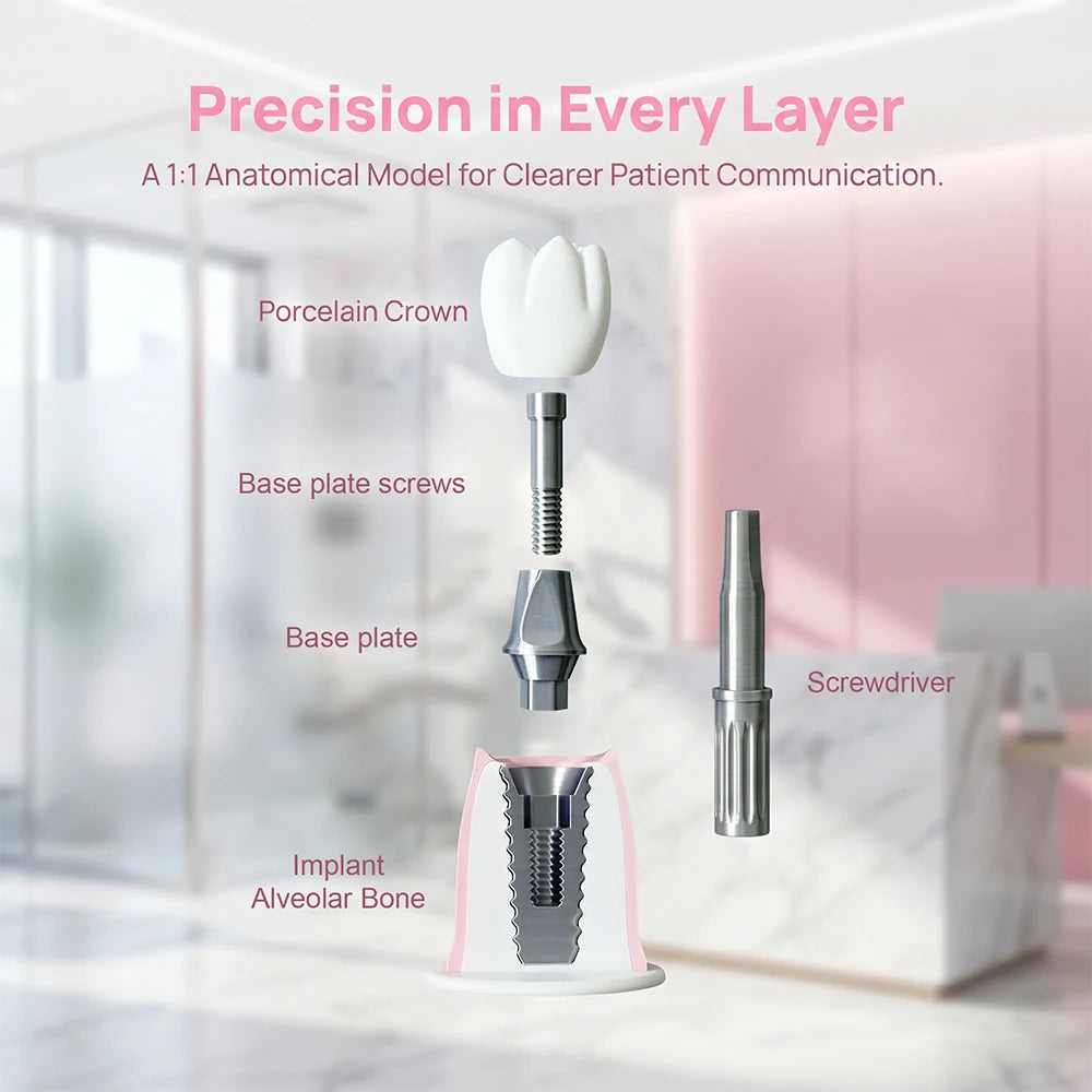 Detachable Implant Demonstration Model (Large)