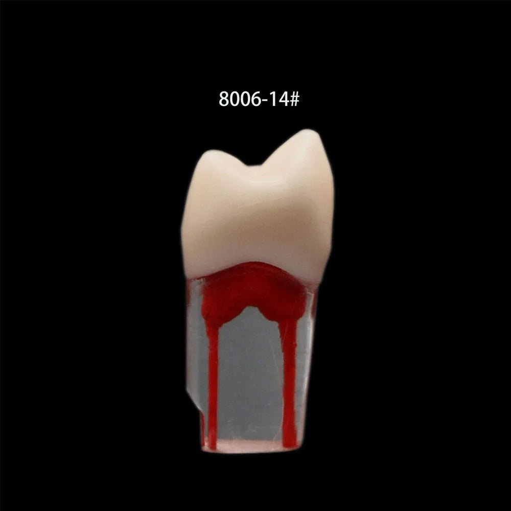 OLEVO 10 Pcs Dental RCT Endo Teeth Model Endodontic Root Canal Block Pulp Cavity Resin Study Practice Endodontic Training M8006