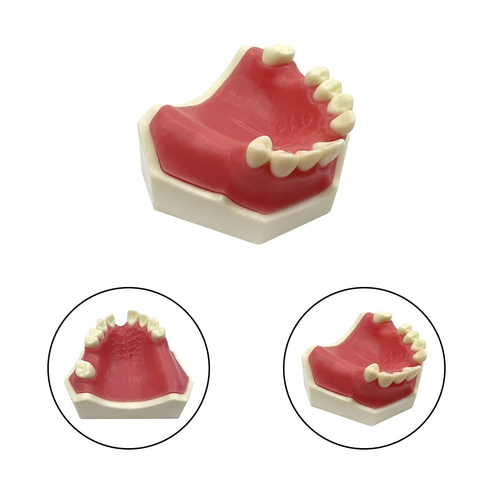 Maxillary Sinus & Implant Teaching Model (Soft Gum)