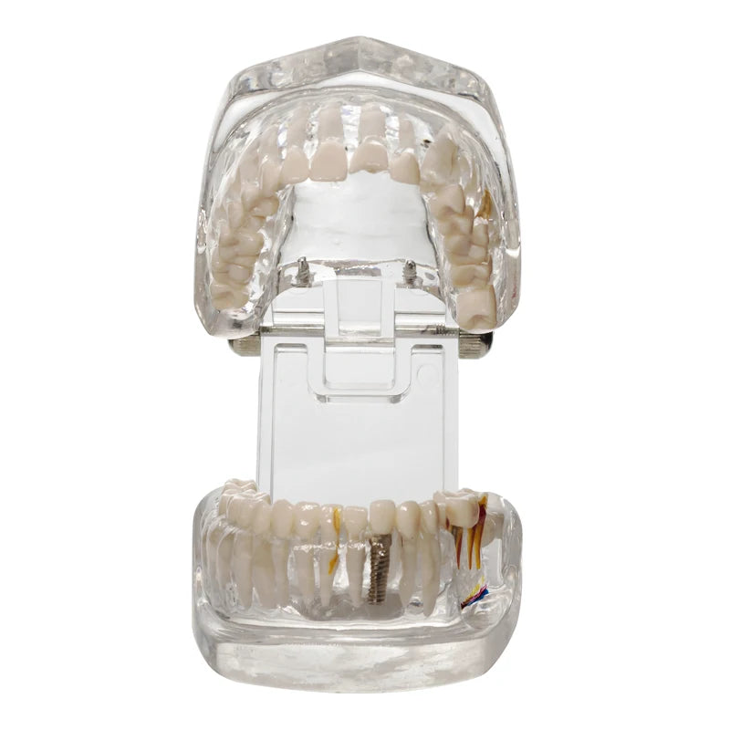 Transparent Oral Pathology Teaching Model