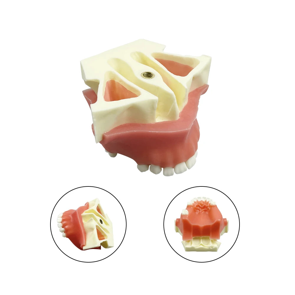 Maxillary Sinus & Implant Teaching Model (Soft Gum)
