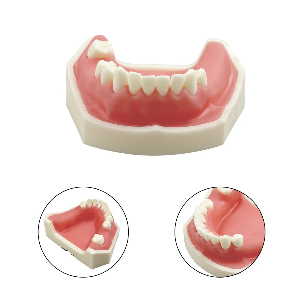 Maxillary Sinus & Implant Teaching Model (Soft Gum)
