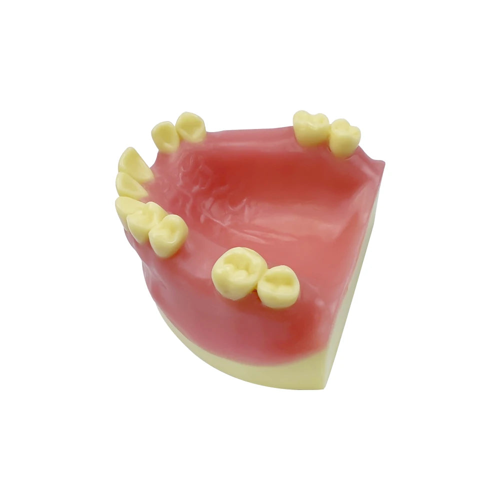 Maxillary Sinus & Implant Teaching Model (Soft Gum)