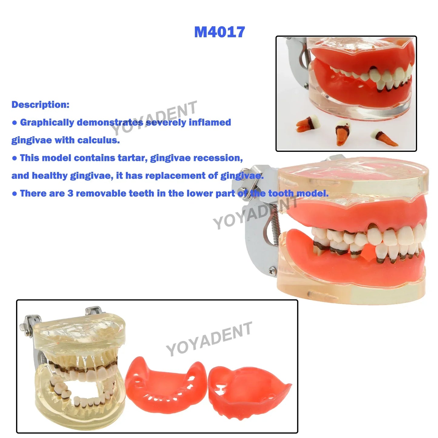 Dental Pathology Demonstration Model II