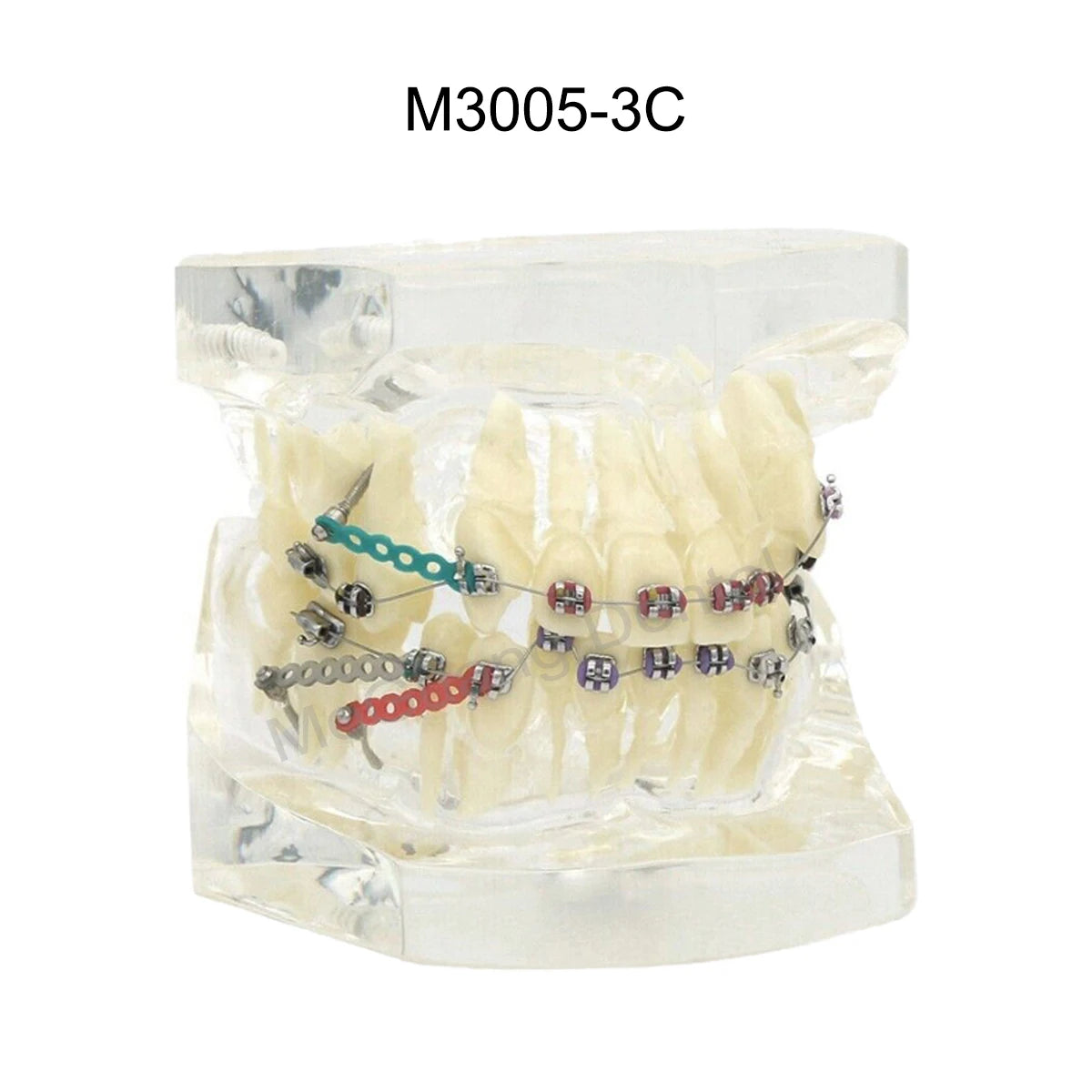 Dental Teeth Model Implant with Removable Dental Education Model for Dentistry Laboratory Demo Studying Dentistry Products Tool