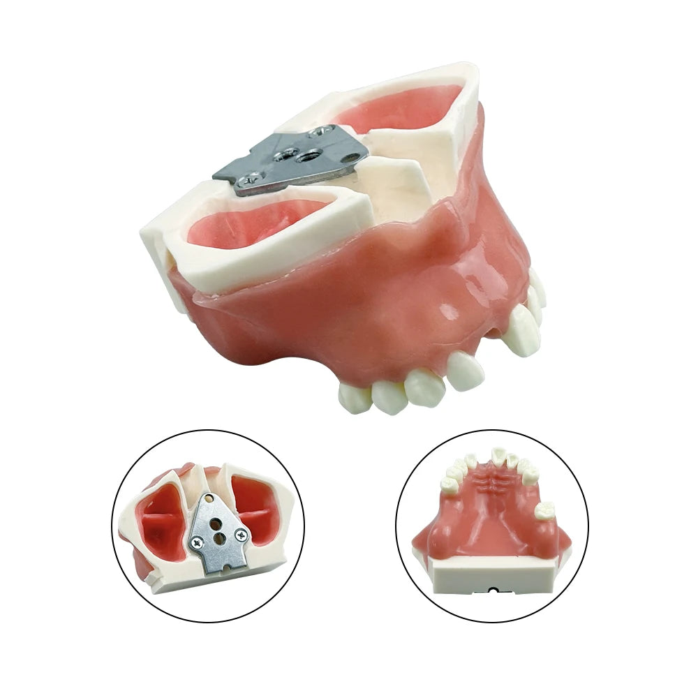 Maxillary Sinus & Implant Teaching Model (Soft Gum)