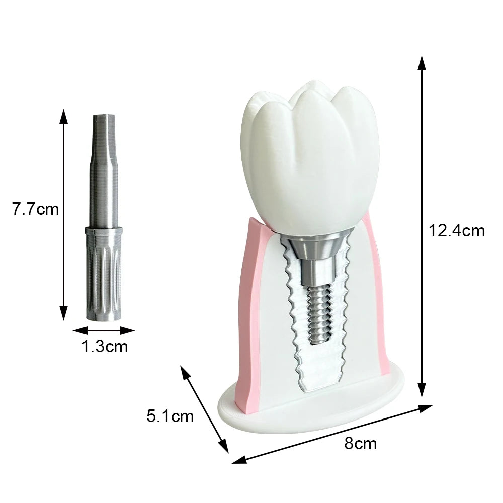 Detachable Implant Demonstration Model (Large)
